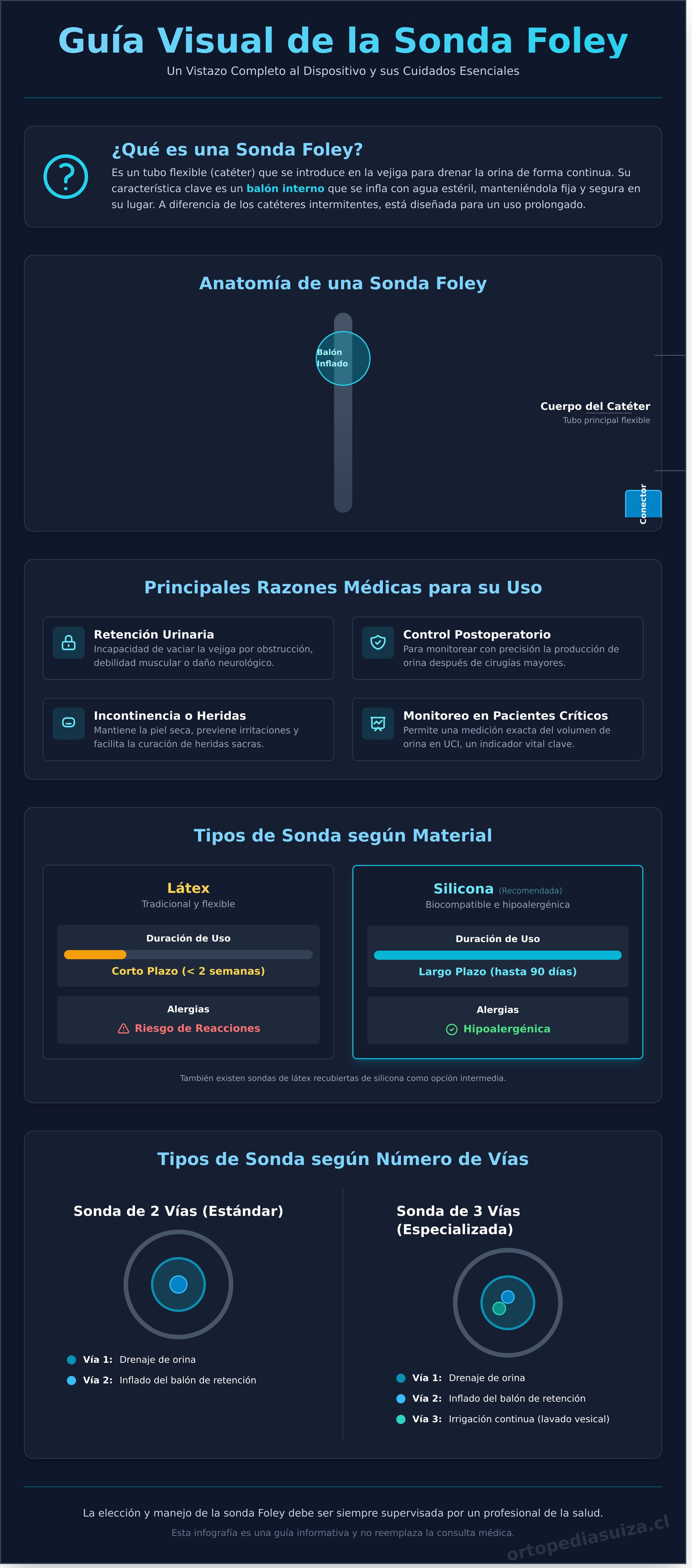 Sonda foley infographic - visual guide