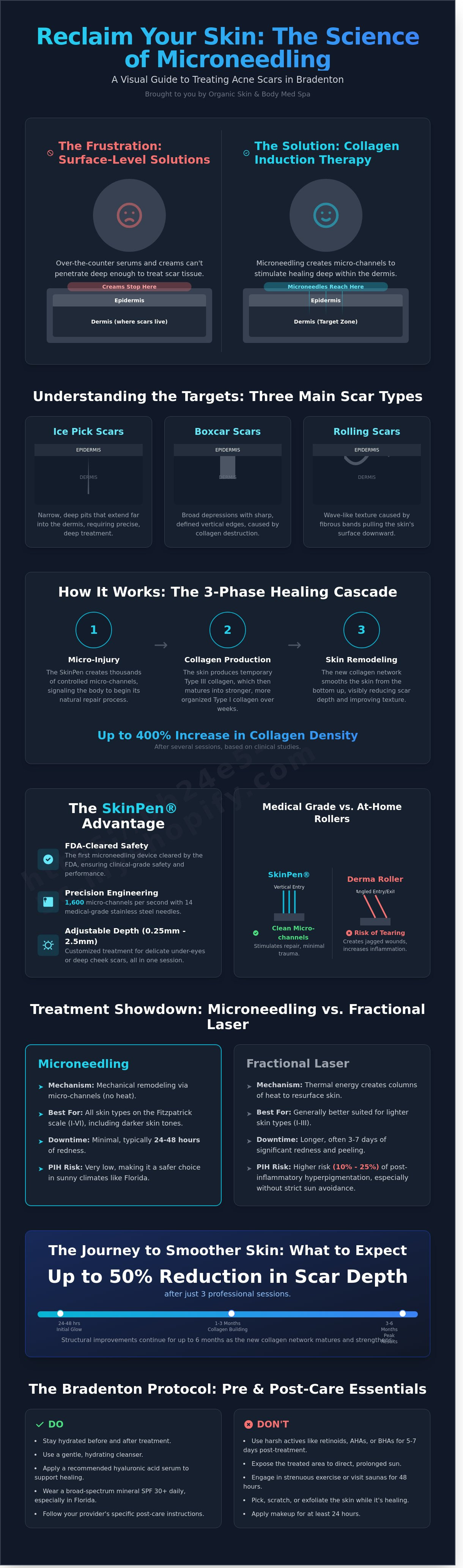 Microneedling for acne scars bradenton