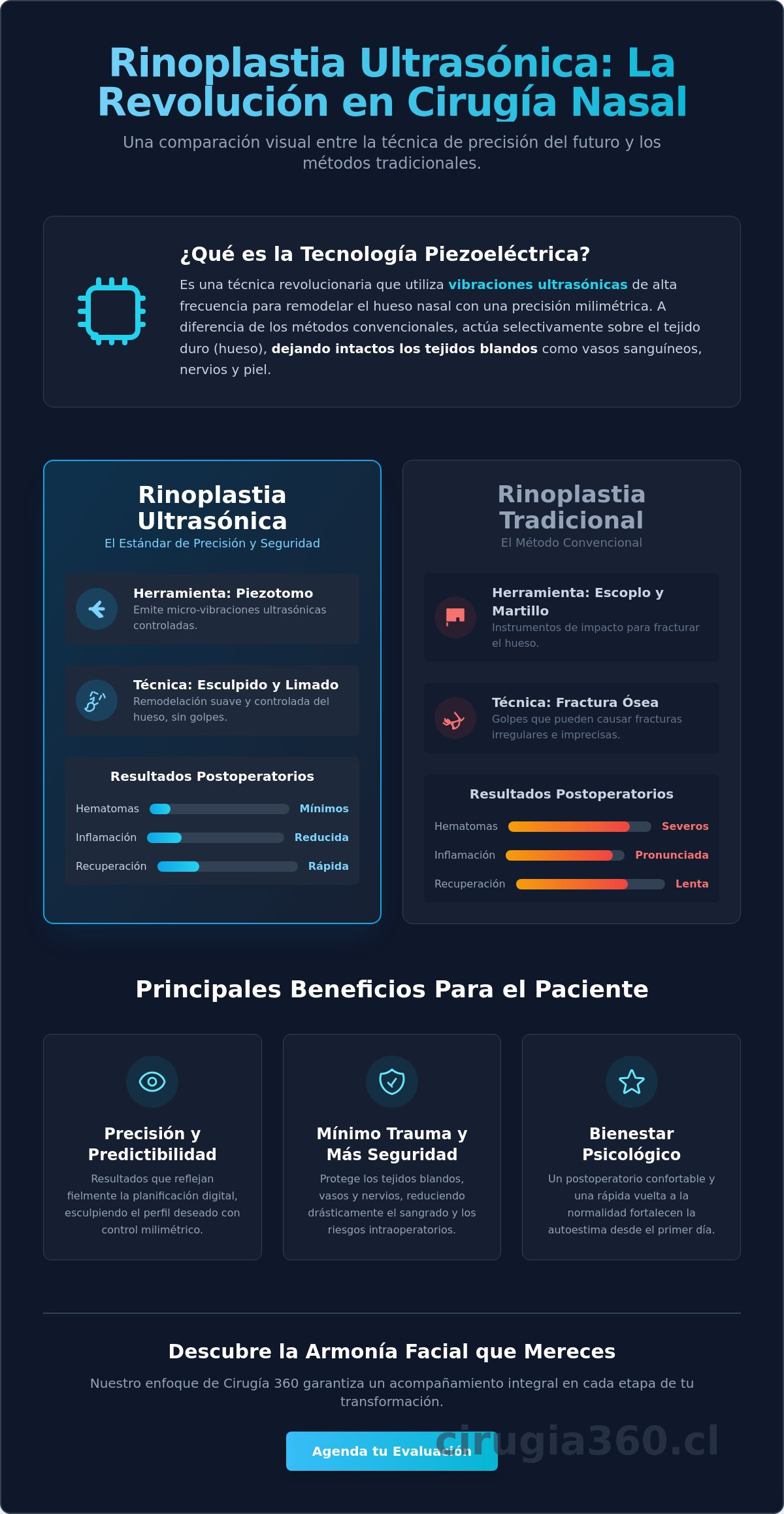 Beneficios de la rinoplastia ultrasonica