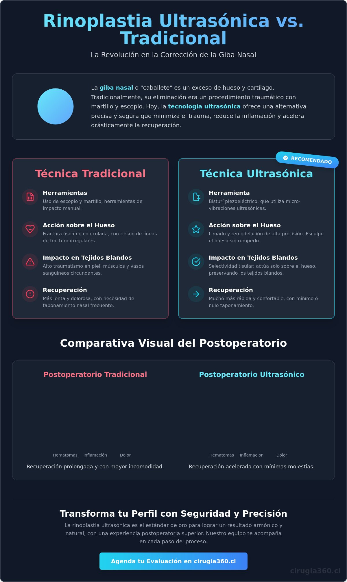 Rinoplastia ultrasónica para giba nasal chile