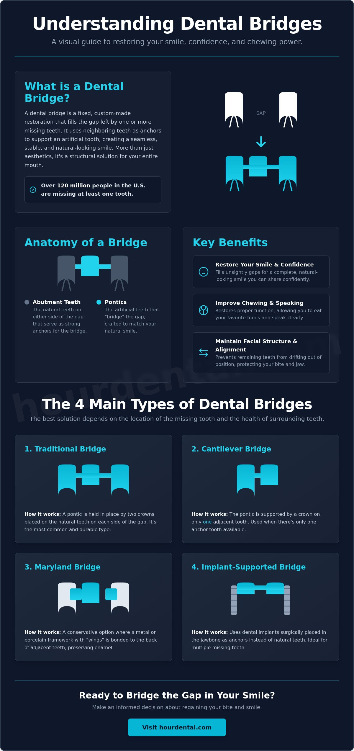 What is a dental bridge