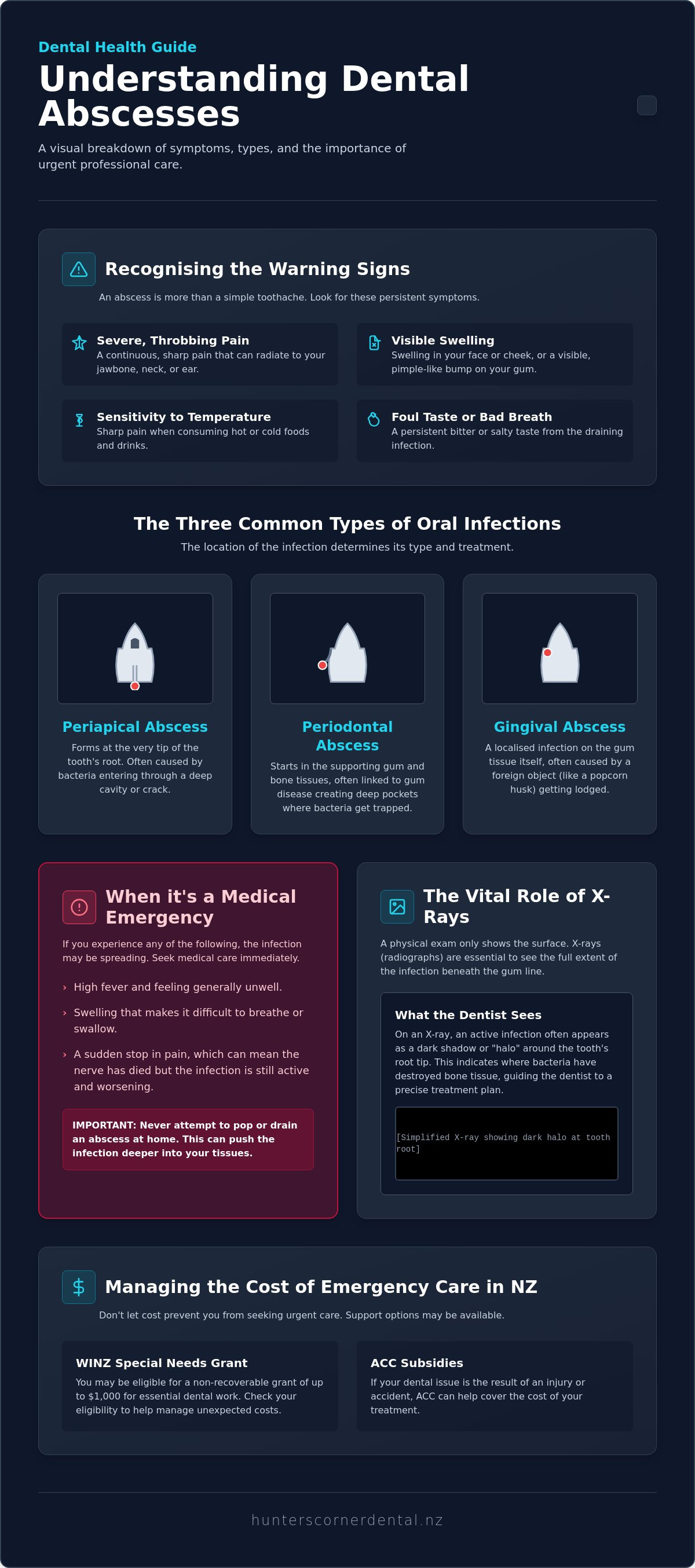 Dental abscess treatment nz