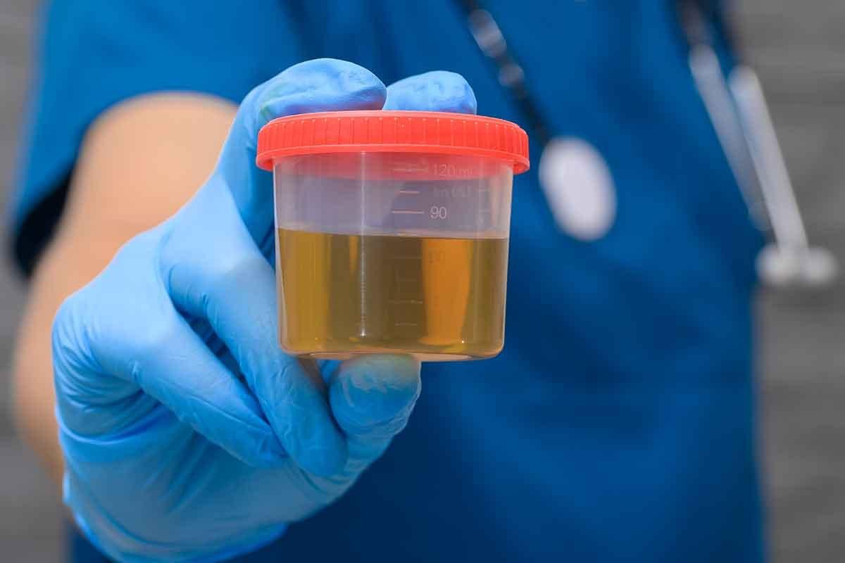 Nitrofurantoin for UTIs: A Clinical Safety and Treatment Checklist