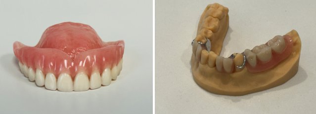 Partial vs Full Dentures: Choosing Your Restoration