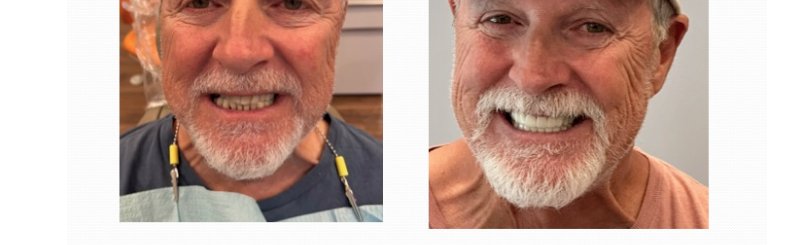 Cosmetic Dentistry Falls Church: Elite Smile Design