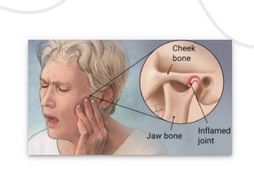 TMJ Specialist Falls Church VA: Relieving Jaw Pain