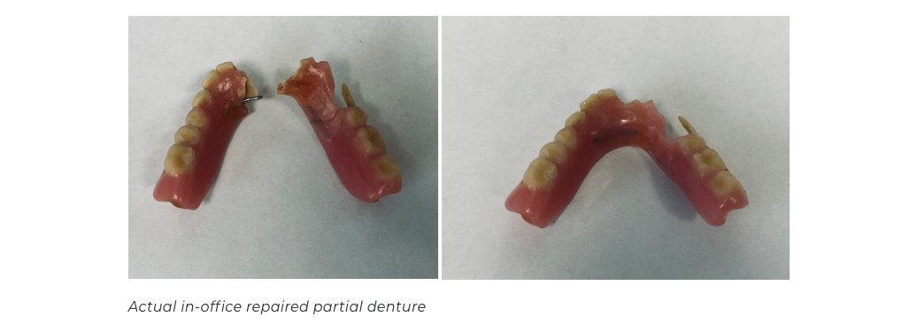 Complete broken denture repair Fairfax VA Guide for Success