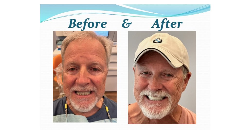 smile makeover consultation Falls Church Best Practices and Expert Advice