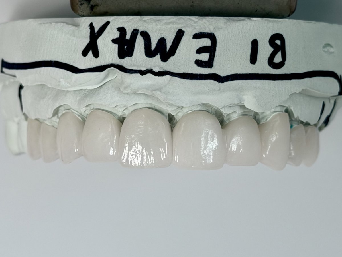 how to afford full mouth reconstruction Best Practices and Expert Advice