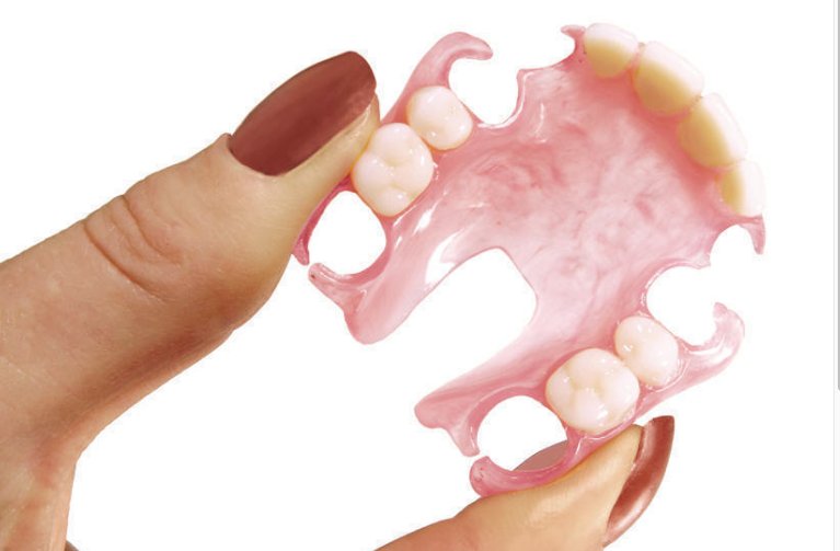 Complete flexible partial dentures pros and cons Guide for Success