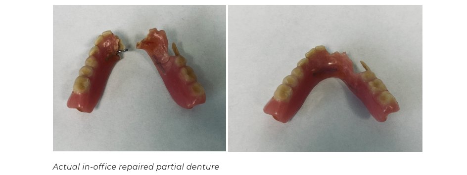 Complete same day denture reline arlington va Guide for Success