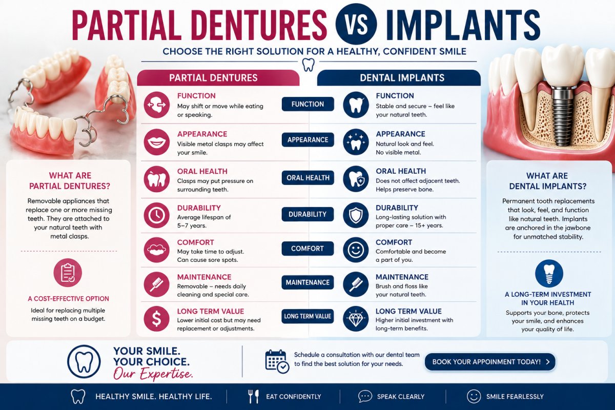 Partial Denture vs. Implant: A Specialist’s Guide to Replacing Missing Teeth (2026)