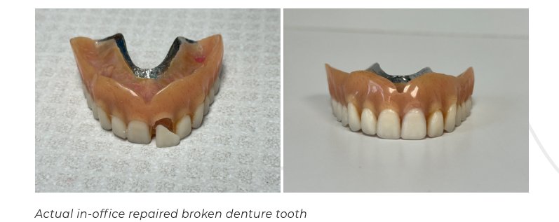 Same Day Denture Repair in Falls Church: The Specialist’s Emergency Guide (2026)