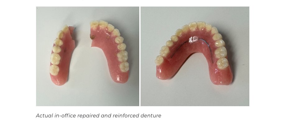 emergency denture repair near me: Everything You Need to Know