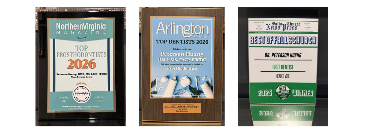 The Ultimate Guide to restorative dentistry northern virginia