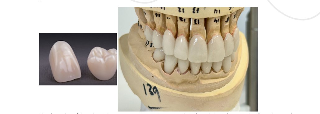 best material for dental crowns Best Practices and Expert Advice
