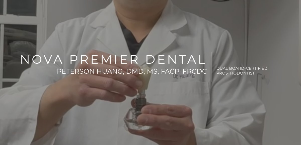 The Ultimate Guide to prosthodontist for dental implants Tysons