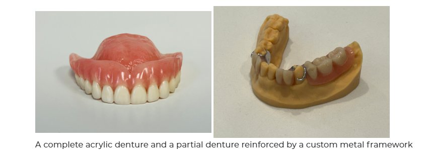 How Often Should You Replace Your Dentures? A Specialist’s Guide (2026)