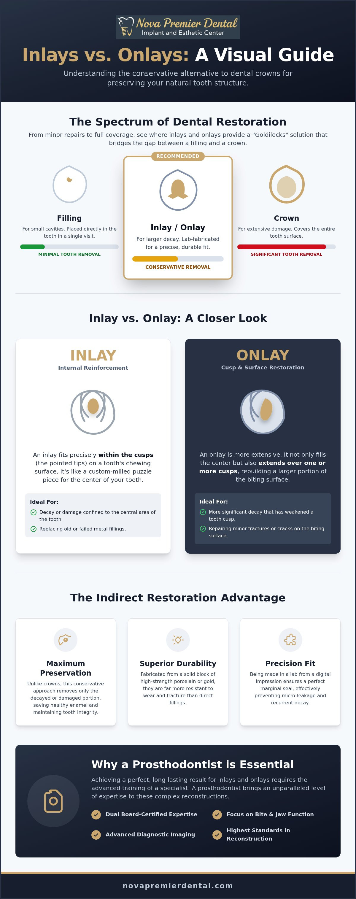 Inlays vs onlays