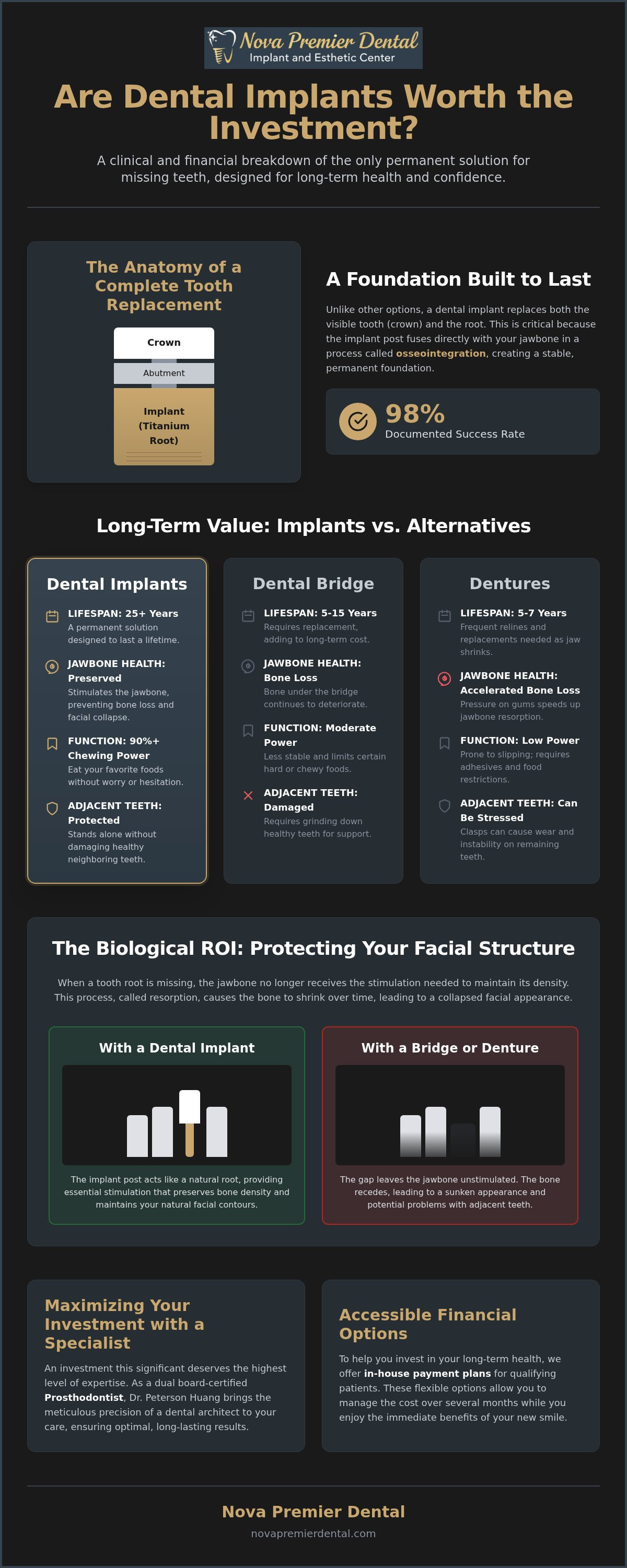 Are dental implants worth it
