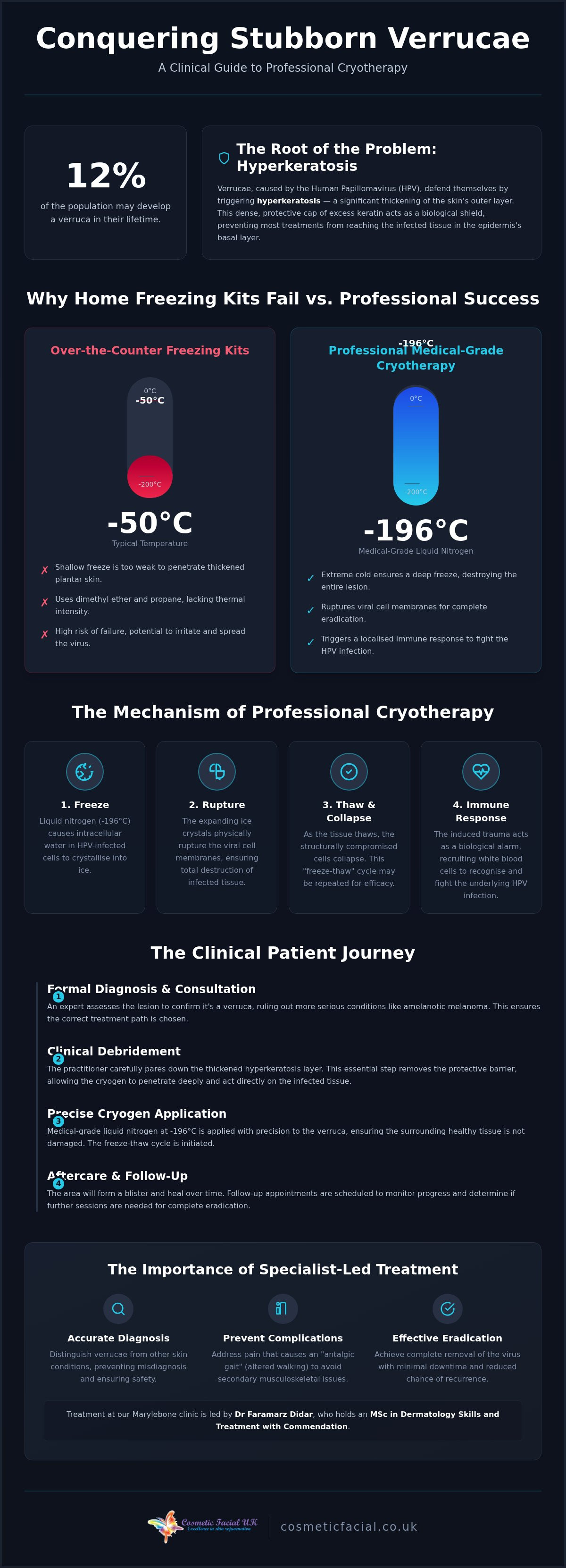 Cryotherapy for verruca removal london