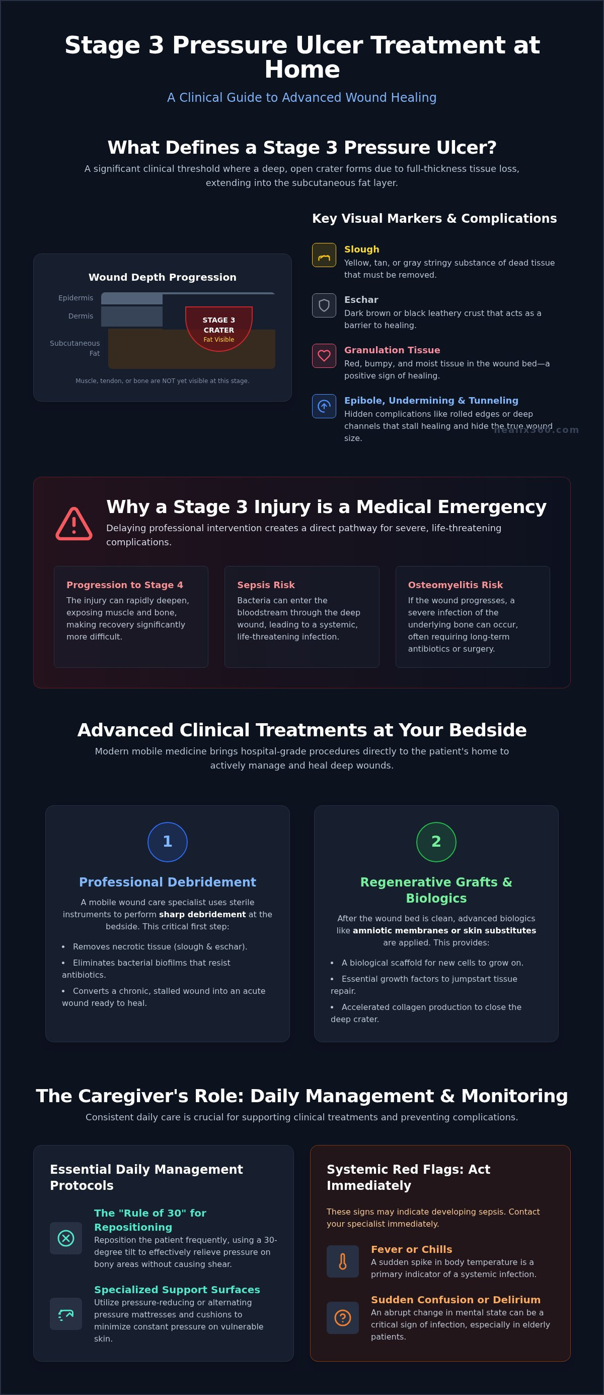 Stage 3 pressure ulcer treatment at home