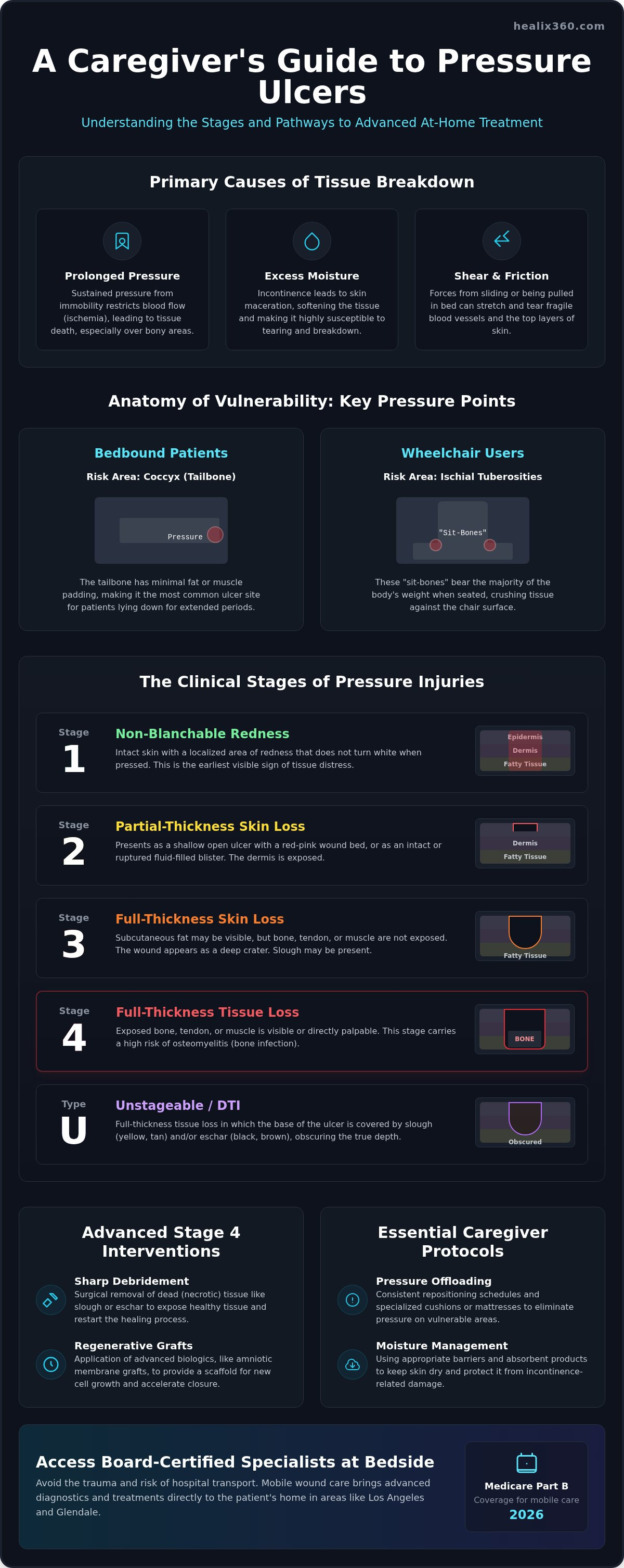 Stage 4 pressure ulcer buttocks treatment