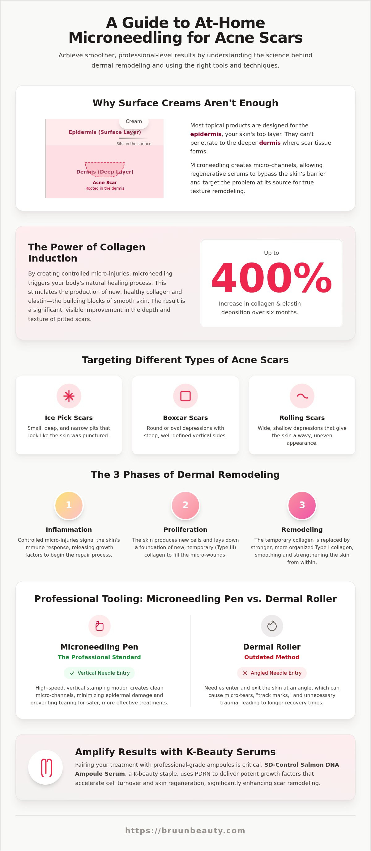 Microneedling for acne scars at home