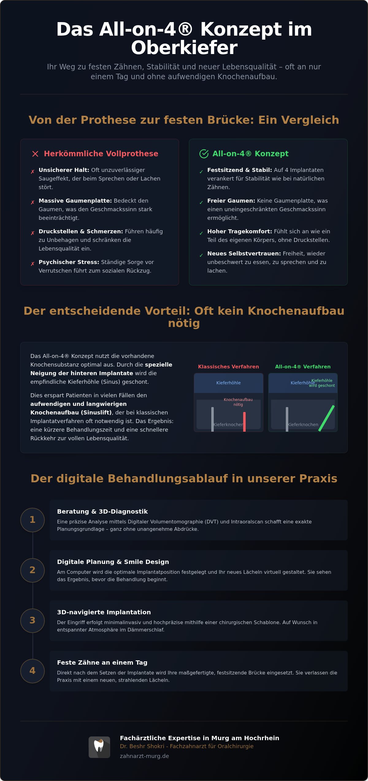 All on 4 oberkiefer erfahrungen